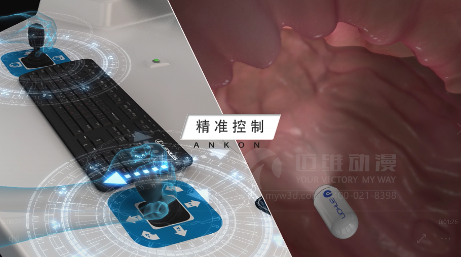 醫(yī)學(xué)醫(yī)療三維動(dòng)畫 醫(yī)學(xué)醫(yī)療三維動(dòng)畫