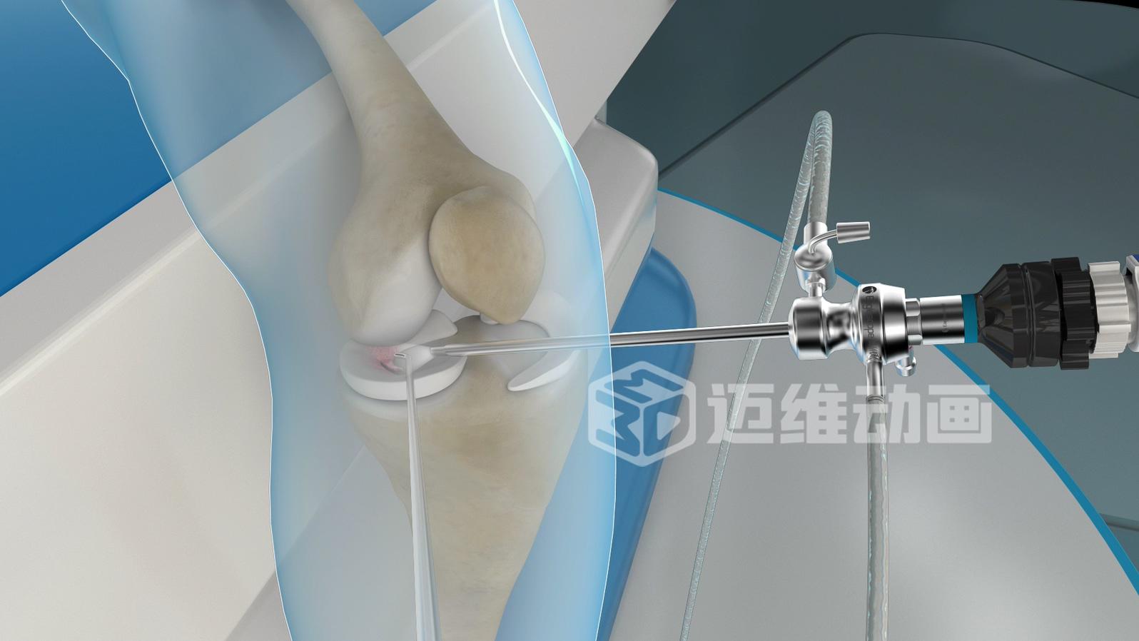 從 “看不懂” 到 “秒懂”，醫(yī)學(xué)醫(yī)療三維動畫憑什么兼顧專業(yè)度與傳播力？(圖1)